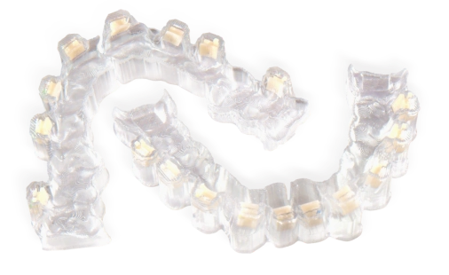 <span class="text-[#8F61D4]">PrecisionFit® Customised</span><br/>Braces Positioner