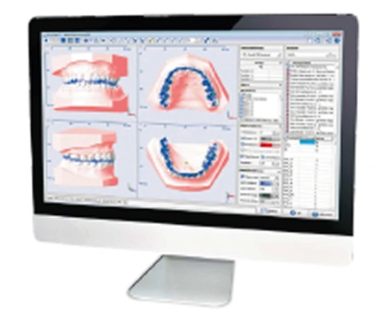 <span class="text-[#8F61D4]">AI-Powered</span><br/>Treatment Advisory