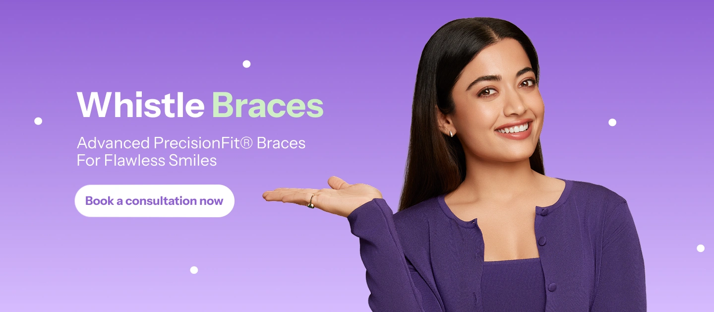 Braces Banner