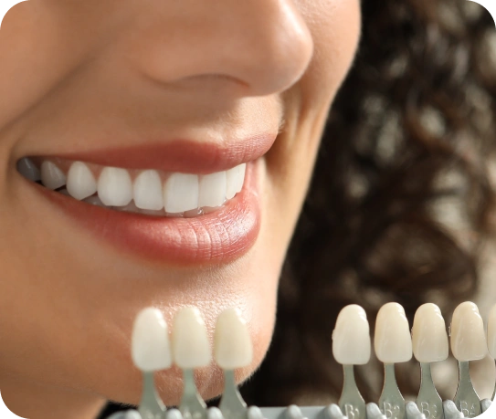 Understanding Crowns