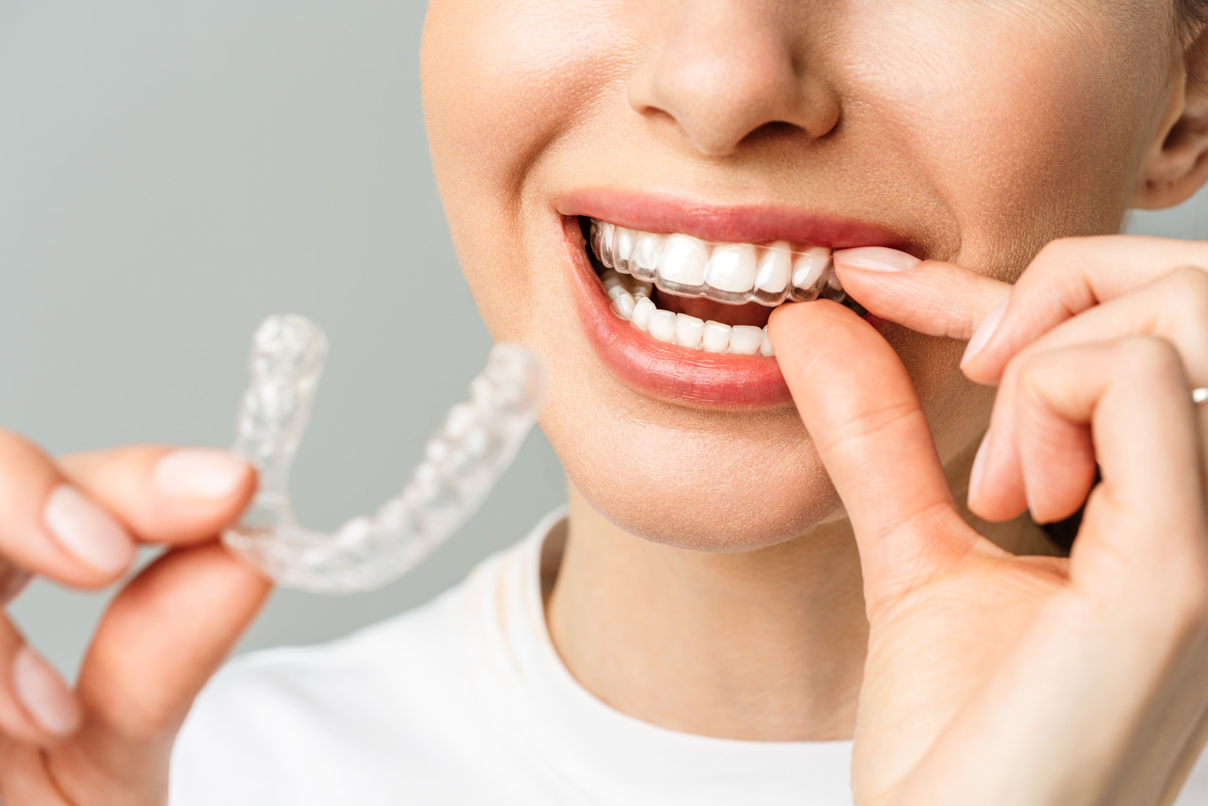 Aligners-location-details-banner
